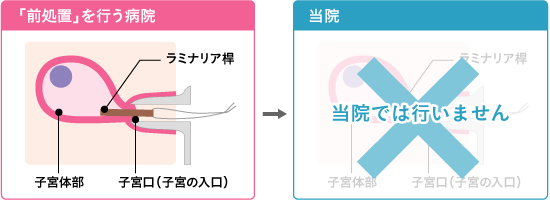 一般的な病院で行う「前処置」は、当院では行いません。